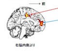 糖分より栄養バランスを重視して! "脳トレ"の川島教授が語る"朝食"の重要性