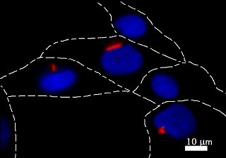 育毛技術に新展開！発毛シグナルの要、毛乳頭細胞の一次繊毛の観察・定量化に成功