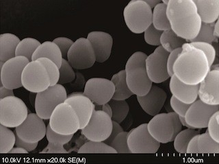 花粉症の症状緩和に「フェカリス菌」の効果を実証 -フェカリス菌広報事務局