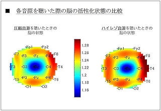 音楽をハイレゾで聴くと快感が増幅する? 電通サイエンスジャム調査