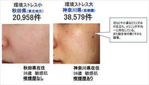 都市部在住者の肌は老けやすいと判明!　タバコなど環境ストレスが影響