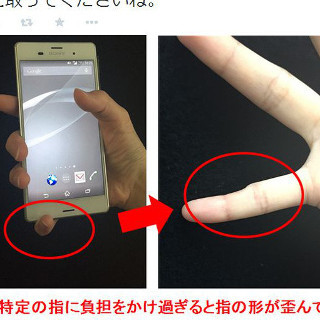 ドコモ、スマホで指が変形する「テキストサム損傷」に注意喚起ツイート