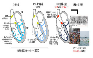 東京医科歯科大学、運動中の突然死に関連する新遺伝子を同定と発表