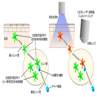 がんワクチン改良へ光明か - キラーT細胞に重要な細胞の生体内可視化に成功