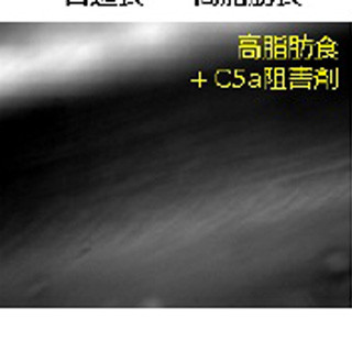 東京医科歯科大学、動脈硬化発症の鍵となる分子を同定 - 治療法開発へ期待