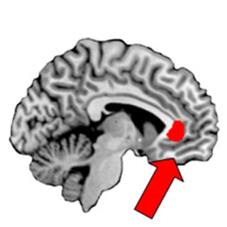 幸福度の高い人ほど内側前頭前野の一領域の体積が大きい - 生理研発表