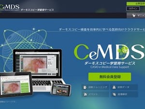 カシオ、画像解析の応用技術で国際コンテスト「ISBIチャレンジ」の1位に