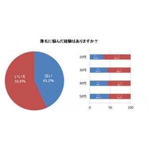 20代の3人に1人が「薄毛」に悩んでいる - 悩みを感じ始めた年齢は?