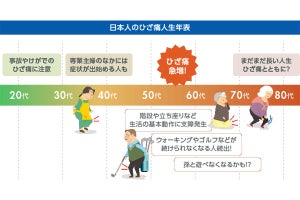 ひざの痛みが出てきた年齢は? - 職業別で出始めのタイミングに差