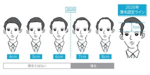 「薄毛」だと思うのは眉上何センチから?