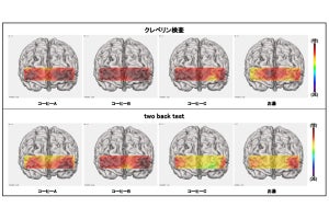 リモートワーク中にコーヒー摂取で集中力と記憶力が向上 - UCCが検証