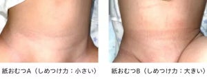 紙おむつによる腹部へのしめつけが乳幼児の睡眠に影響