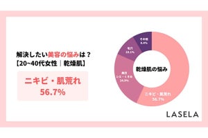 3位は洗顔料! ニキビ・肌荒れの悩みを解決できた商品の1位は?