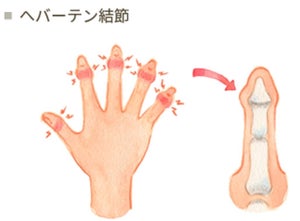 寒くなると出やすい「更年期」の症状とは? 大塚製薬が解説