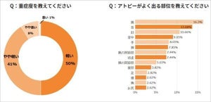 アトピー体質の人に聞いた、入浴頻度はどれくらい?