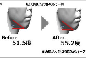 “ガムを噛む”とフェイスラインが引きあがる⁉ 女性8割が気にする「たるみ」の一助となるか