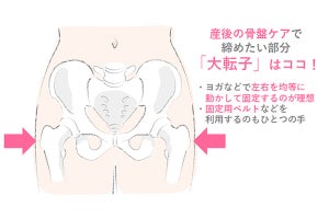 お産で骨盤がゆがむ仕組みとは? 産婦人科医が教える「体型戻し」の知識