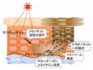 東北大とコーセー、美白に向けた新たなアプローチ手法を開発