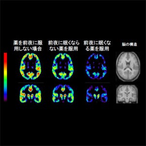 東北大、鎮静性抗ヒスタミン薬による二日酔いのメカニズムを解明