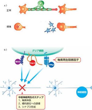 阪大、傷ついた視神経の再生抑制機構を解明 - マウスの視神経再生に成功