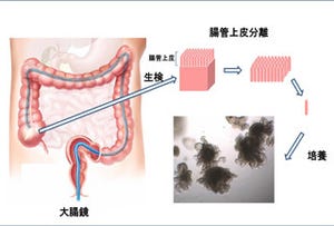 慶応大など、iPS/ES細胞を使わずにヒト腸管上皮幹細胞の長期大量培養に成功