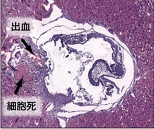 九大、生体内の鉄の量を調節するたんぱく質の機能を解明