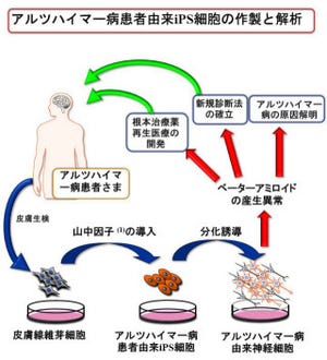 慶應、iPS細胞技術を利用してアルツハイマー病の「アミロイド仮説」を実証