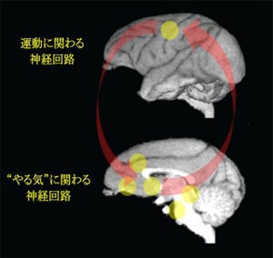 "元気"と"やる気"が高いとリハビリも効果大 - NIPSなどが脳科学的に証明