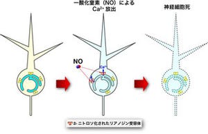 東大など、脳梗塞などで生じる神経細胞死メカニズムの一端を解明