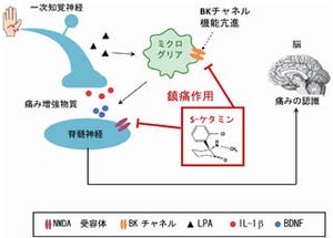 九大、S体ケタミンの神経障害性疼痛に対する鎮痛作用の標的分子を特定