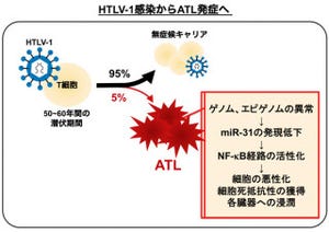 東大、「成人T細胞白血病」細胞の増殖と生存のメカニズムの一端を解明