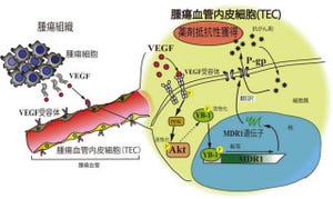 北大、従来の常識を覆してがん内の血管も薬剤耐性が起こることを発見