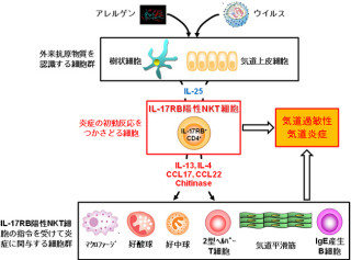 理研ら、「IL-17RB陽性NKT細胞」が小児ぜん息のカギを握っていることを確認