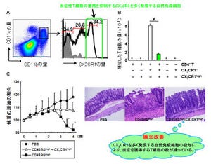 阪大など、腸の自然免疫細胞の炎症抑制と炎症性腸疾患の仕組みを解明