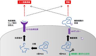 日本人は胃がんになりやすいが十二指腸潰瘍にはなりにくい - 東大が発見