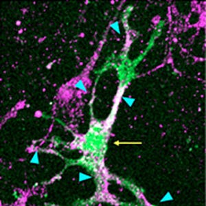 理研、アルツハイマーなどの脳疾患で生じるシグナル異常の原因の一端を解明