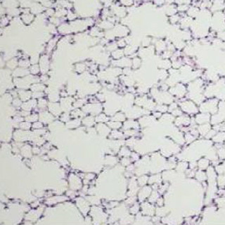 理研、喫煙によって慢性閉塞性肺気腫の発症が早まるメカニズムを解明