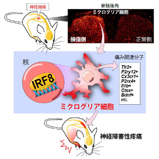 九大など、神経障害性疼痛が引き起こされる仕組みを解明