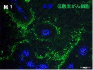 京大、悪性がん内の一部のがん細胞が放射線治療後に再発する仕組みを解明