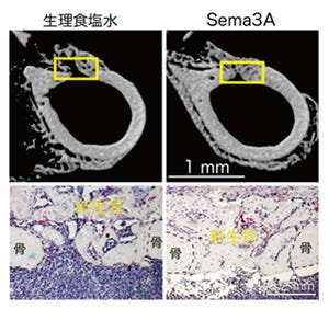 東京医科歯科大、骨の形成と破壊を同時にコントロールするたんぱく質を発見