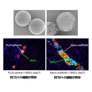 大阪市大、血管新生療法の治療効果を増幅させるナノテク微粒子を開発