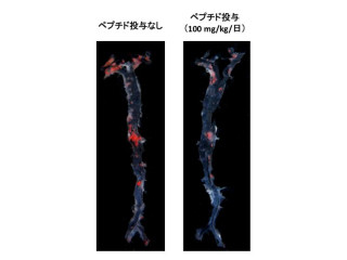 九大、「低分子ペプチド」の摂取により血管の収縮を防げることを確認