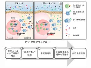 腸内細菌のバランスの崩れが自己免疫疾患につながる? - 理研が発表