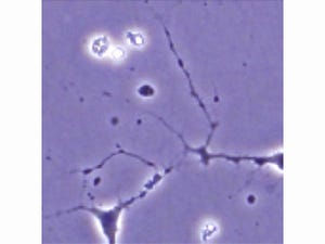 京大ら、ES細胞に筋萎縮性側索硬化症を過剰発現させた疾患モデル細胞を作成