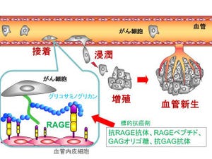 北大、がん細胞の肺への転移が引き起こされるメカニズムを明らかに