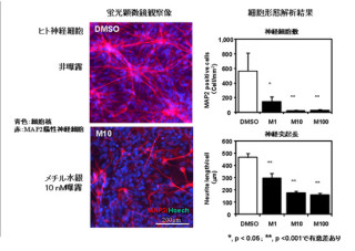 ヒト胎児の神経細胞はメチル水銀による悪影響を受けやすい - 環境研ら発見