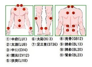 京大、「慢性閉塞性肺疾患」患者の労作時呼吸困難は鍼治療が有効と実証