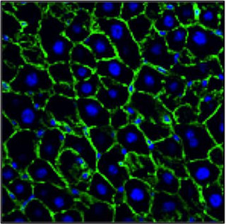 肝臓の再生には肝細胞の分裂よりも肥大が重要 - 東大などが確認