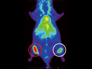 理研、乳がん患者向けの治療効果や転移の有無の非侵襲的な診断手法を開発