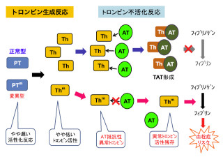 名大、原因不明の「遺伝性血栓症」の新たな血栓性素因を発見